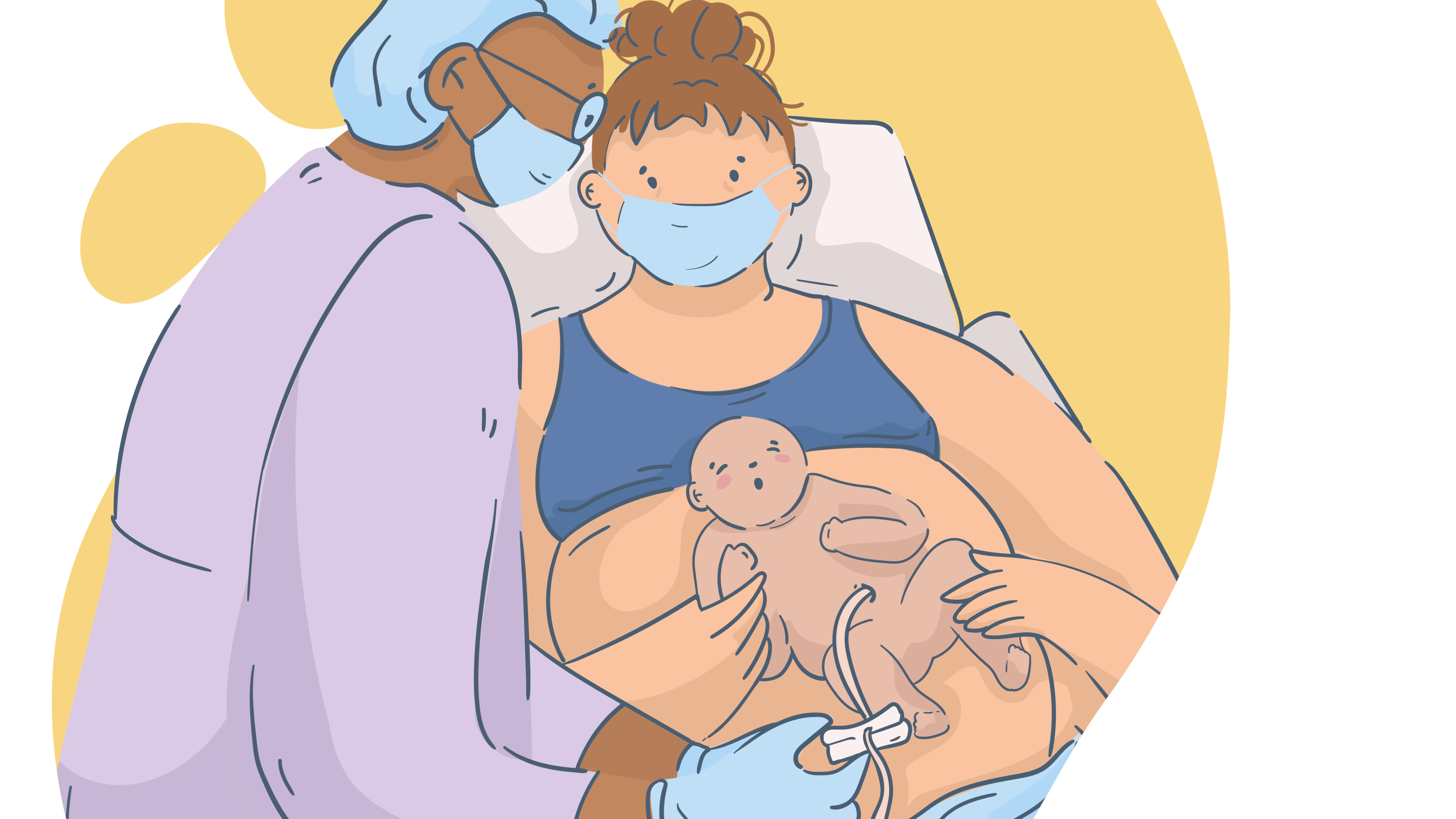 Ligadura del cordón